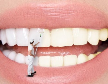 Removing Yellow Stains from Teeth at Home