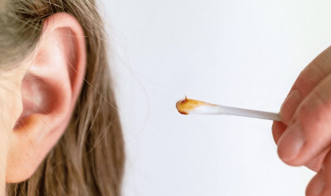 How To Properly Remove Ear Wax