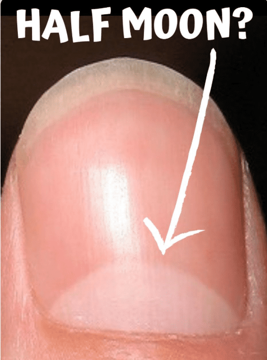 What Does The Half Moon at The Base of The Nails Mean