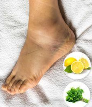 Reduce Swelling in the Feet and Legs