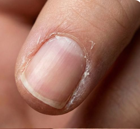 If you have these lines on your nails after 40, it is a clear sign that..