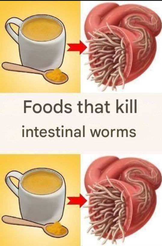 7 Foods That Kill Worms in the Intestine