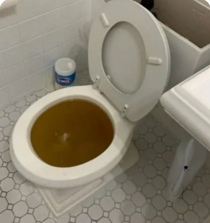 Why Is It Extremely Important Not to Flush the Toilet After Every Urination?